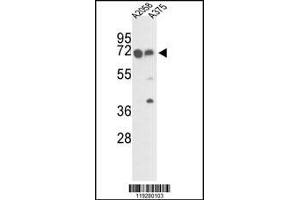 Western blot analysis of FKBP10 Antibody in A2058 and A375 cell line lysates (35ug/lane) (FKBP10 抗体  (C-Term))