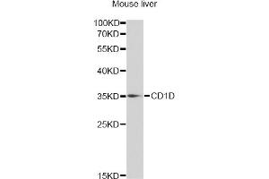 Western blot analysis of extracts of mouse liver, using CD1D antibody (ABIN6292676) at 1:1000 dilution. (CD1d 抗体)