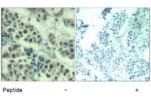 Image no. 3 for anti-Mdm2, p53 E3 Ubiquitin Protein Ligase Homolog (Mouse) (MDM2) (Ser166) antibody (ABIN319418) (MDM2 抗体  (Ser166))