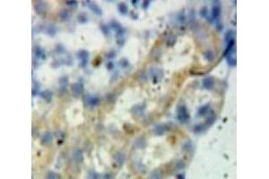 Used in DAB staining on fromalin fixed paraffin-embedded Kidney tissue (BCL2L1 抗体  (AA 2-212))