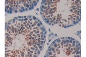 Immunohistochemistry (IHC) image for anti-DnaJ (Hsp40) Homolog, Subfamily B, Member 1 (DNAJB1) (AA 2-340) antibody (ABIN7432811)