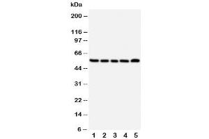 Western blot testing of NK1R antibody and Lane 1:  A549 (TACR1 抗体  (Middle Region))