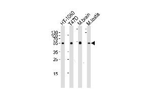 Western blot analysis of lysates from HT-1080, T47D cell line, mouse brain and testis tissue lysate (from left to right), using TUBA1C Antibody at 1:1000 at each lane. (TUBA1C 抗体  (N-Term))
