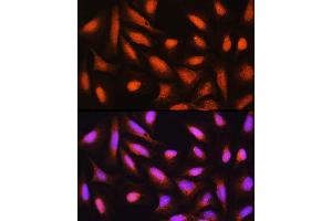 Immunofluorescence analysis of U-2 OS cells using GMFB Rabbit pAb (ABIN6131732, ABIN6141181, ABIN6141182 and ABIN6224741) at dilution of 1:100 (40x lens). (GMFB 抗体  (AA 1-140))