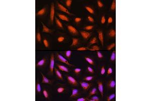 Immunofluorescence analysis of U-2 OS cells using GMFB Rabbit pAb (ABIN6131732, ABIN6141181, ABIN6141182 and ABIN6224741) at dilution of 1:100 (40x lens). (GMFB 抗体  (AA 1-140))