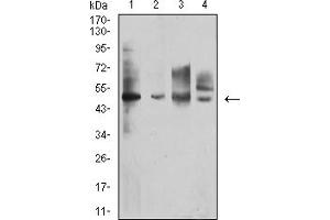 Western Blotting (WB) image for anti-Interleukin 13 Receptor, alpha 1 (IL13RA1) (AA 22-343) antibody (ABIN7193280)
