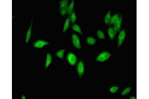 Immunofluorescent analysis of Hela cells using ABIN7174571 at dilution of 1:100 and Alexa Fluor 488-congugated AffiniPure Goat Anti-Rabbit IgG(H+L) (ube3a 抗体  (AA 83-234))