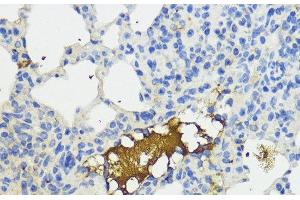 Immunohistochemistry of paraffin-embedded Mouse lung using Complement Factor B Polyclonal Antibody at dilution of 1:200 (40x lens). (Complement Factor B 抗体)