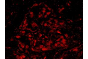 Immunofluorescence (IF) image for anti-Breast Cancer 1 (BRCA1) (AA 700-750) antibody (ABIN7448934) (BRCA1 抗体  (AA 700-750))