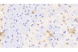 Detection of GAB2 in Mouse Cerebrum Tissue using Polyclonal Antibody to GRB2 Associated Binding Protein 2 (GAB2) (GAB2 抗体  (AA 357-607))