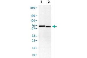 Western Blot analysis of Lane 1: NIH-3T3 cell lysate (mouse embryonic fibroblast cells) and Lane 2: NBT-II cell lysate (Wistar rat bladder tumour cells) with STK3 polyclonal antibody . (STK3 抗体)