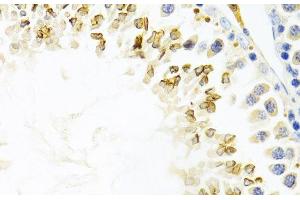 Immunohistochemistry of paraffin-embedded Mouse testis using GEMIN2 Polyclonal Antibody at dilution of 1:100 (40x lens). (SIP1 抗体)
