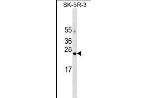 AGTR Antibody (C-term) 18437b western blot analysis in SK-BR-3 cell line lysates (35 μg/lane). (AGTRAP 抗体  (C-Term))