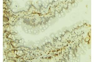 ABIN6277100 at 1/100 staining Mouse colon tissue by IHC-P. (SMARCA4 抗体  (N-Term))