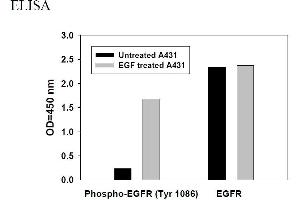 Image no. 4 for Epidermal Growth Factor Receptor (EGFR) ELISA Kit (ABIN625237) (EGFR ELISA 试剂盒)