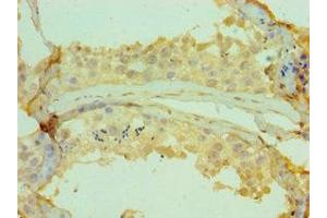 Immunohistochemistry of paraffin-embedded human testis tissue using ABIN7147353 at dilution of 1:100 (CETN2 抗体  (AA 1-172))