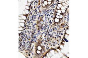 IHC analysis of MED4 using anti-MED4 antibody (ABIN7600817).