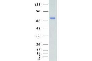 Western Blotting (WB) image for Mitogen-Activated Protein Kinase Kinase Kinase 2 (MAP3K2) protein (Myc-DYKDDDDK Tag) (ABIN2725399)