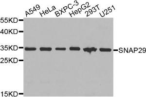 Western blot analysis of extracts of various cell lines, using SNAP29 antibody. (SNAP29 抗体)