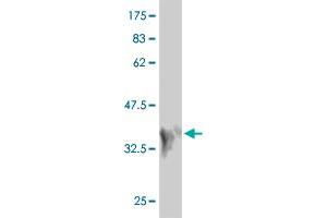 Western Blot detection against Immunogen (36. (MAP2K7 抗体  (AA 1-99))