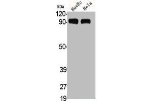 Western Blot analysis of HuvEc HELA cells using ADAMTS-1 Polyclonal Antibody (ADAMTS1 抗体  (Internal Region))