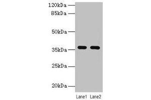 Western blot All lanes: LYPD3 antibody at 4 μg/mL Lane 1: MCF-7 whole cell lysate Lane 2: Mouse stomach tissue Secondary Goat polyclonal to rabbit IgG at 1/10000 dilution Predicted band size: 36 kDa Observed band size: 36 kDa (LYPD3 抗体  (AA 31-326))