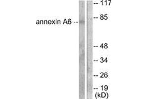 Western blot analysis of extracts from 293 cells, using Annexin A6 Antibody. (ANXA6 抗体  (AA 1-50))