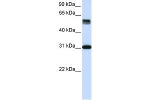 Western Blotting (WB) image for anti-Tripartite Motif Containing 31 (TRIM31) antibody (ABIN2459998)