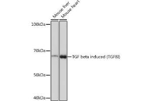 Western blot analysis of extracts of various cell lines, using TGF beta induced TGF beta induced (TGFBI) Rabbit mAb (ABIN7270915) at 1:1000 dilution. (TGFBI 抗体)