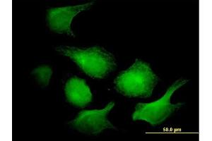 Immunofluorescence of monoclonal antibody to AK1 on HeLa cell. (Adenylate Kinase 1 抗体  (AA 1-194))