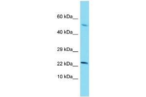 Western Blotting (WB) image for anti-Sterol Carrier Protein 2 (SCP2) (N-Term) antibody (ABIN2774151) (SCP2 抗体  (N-Term))
