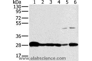 Western blot analysis of Mouse brain and human fetal brain tissue, hela, Raw264. (NDUFS3 抗体)