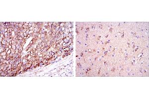 Immunohistochemical analysis of paraffin-embedded liver cancer tissues (left) and brain tissues (right) using ApoE mouse mAb with DAB staining. (APOE 抗体)