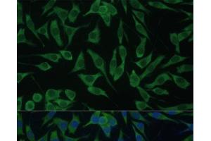 Immunofluorescence analysis of L929 cells using DDX3Y Polyclonal Antibody at dilution of 1:100 (40x lens). (DDX3Y 抗体)