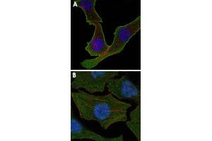 Confocal immunofluorescence analysis of SK-BR-3 (A) and A-549 (B) cells using CALR monoclonal antibody, clone 1G6A7  (green). (Calreticulin 抗体)