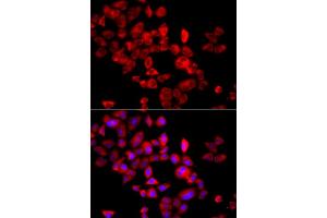 Immunofluorescence analysis of A549 cells using EIF4G1 antibody. (EIF4G1 抗体)