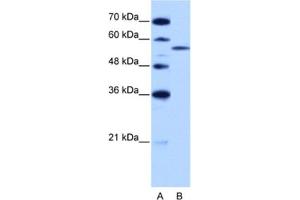 Western Blotting (WB) image for anti-Zinc Finger (CCCH Type), RNA-Binding Motif and serine/arginine Rich 2 (ZRSR2) antibody (ABIN2462182) (ZRSR2 抗体)