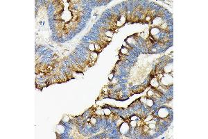 Immunohistochemistry (IHC) image for anti-Angiotensin I Converting Enzyme 2 (ACE2) (AA 18-250) antibody (ABIN6136429)
