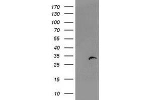 Western Blotting (WB) image for anti-Proteasome (Prosome, Macropain) Subunit, beta Type, 4 (PSMB4) antibody (ABIN1500471) (PSMB4 抗体)