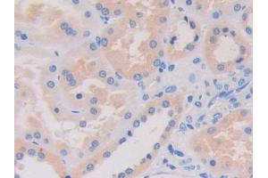 Used in DAB staining on fromalin fixed paraffin- embedded kidney tissue
