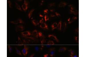 Immunofluorescence analysis of U-2 OS cells using RAB27A Polyclonal Antibody at dilution of 1:100. (RAB27A 抗体)
