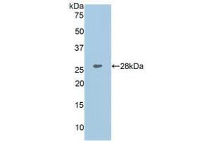 Detection of Recombinant COL1a1, Human using Polyclonal Antibody to Collagen Type I Alpha 1 (COL1a1) (COL1A1 抗体  (AA 1218-1440))