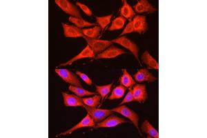 anti-Eukaryotic Translation Initiation Factor 2 alpha Kinase 4 (EIF2AK4) (AA 1-300) antibody
