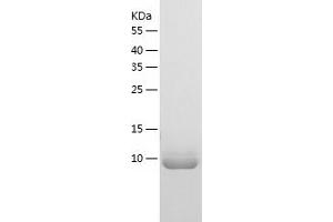 Western Blotting (WB) image for Pro-Platelet Basic Protein (Chemokine (C-X-C Motif) Ligand 7) (PPBP) (AA 35-128) protein (His tag) (ABIN7124561) (CXCL7 Protein (AA 35-128) (His tag))