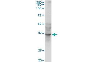 AVEN monoclonal antibody (M08), clone 2B10. (AVEN 抗体  (AA 71-170))