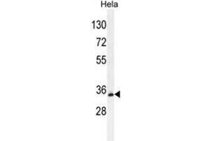 BCKDHB Antibody (N-term) western blot analysis in Hela cell line lysates (35µg/lane). (BCKDHB 抗体  (N-Term))