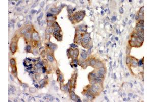 Immunohistochemistry (Paraffin-embedded Sections) (IHC (p)) image for anti-Sulfotransferase Family, Cytosolic, 2B, Member 1 (SULT2B1) (AA 190-218), (Middle Region) antibody (ABIN3043414) (SULT2B1 抗体  (Middle Region))