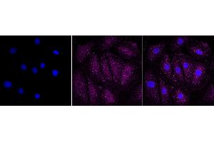 anti-PTK2B Protein tyrosine Kinase 2 beta (PTK2B) antibody