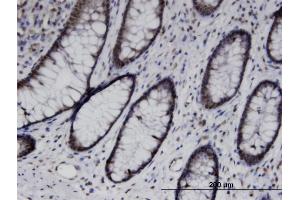 Immunoperoxidase of monoclonal antibody to UBASH3B on formalin-fixed paraffin-embedded human colon. (UBASH3B 抗体  (AA 344-441))