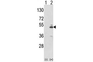 Western Blotting (WB) image for anti-Pyruvate Kinase M2 (PKM2) (AA 116-145) antibody (ABIN3032239)